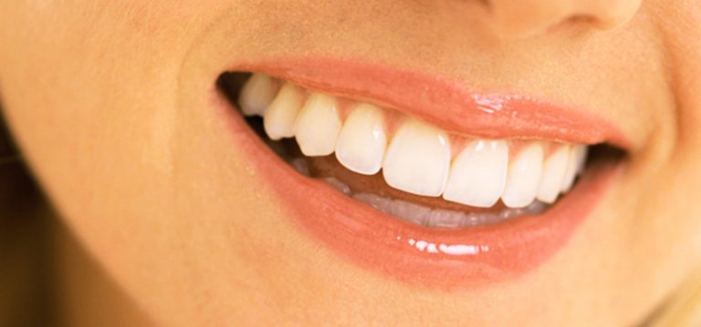 Dental Treatment and Aesthetics Bodrum